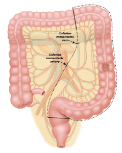 Surgical Techniques - UHN Colorectal Program